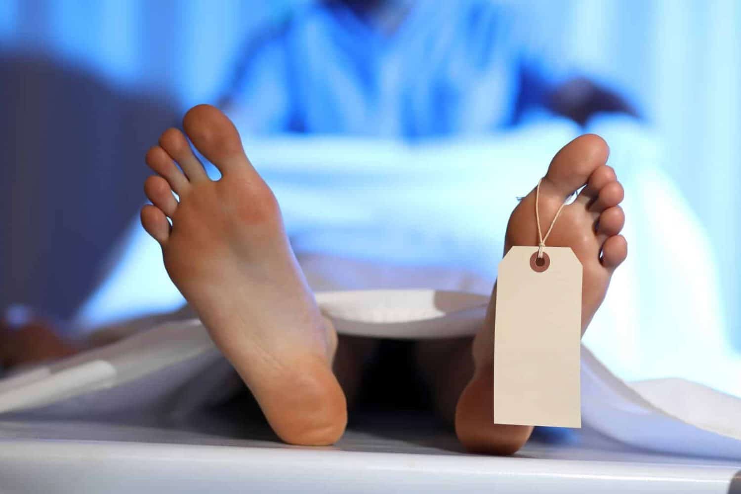 cadaver