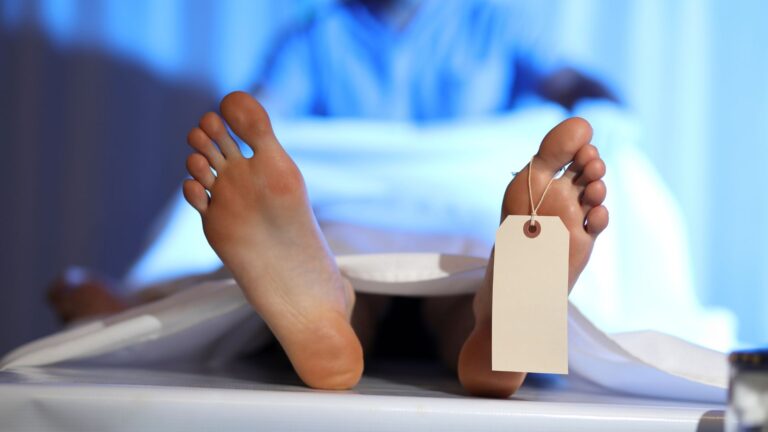 cadaver