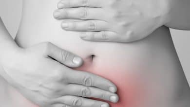endometriosis