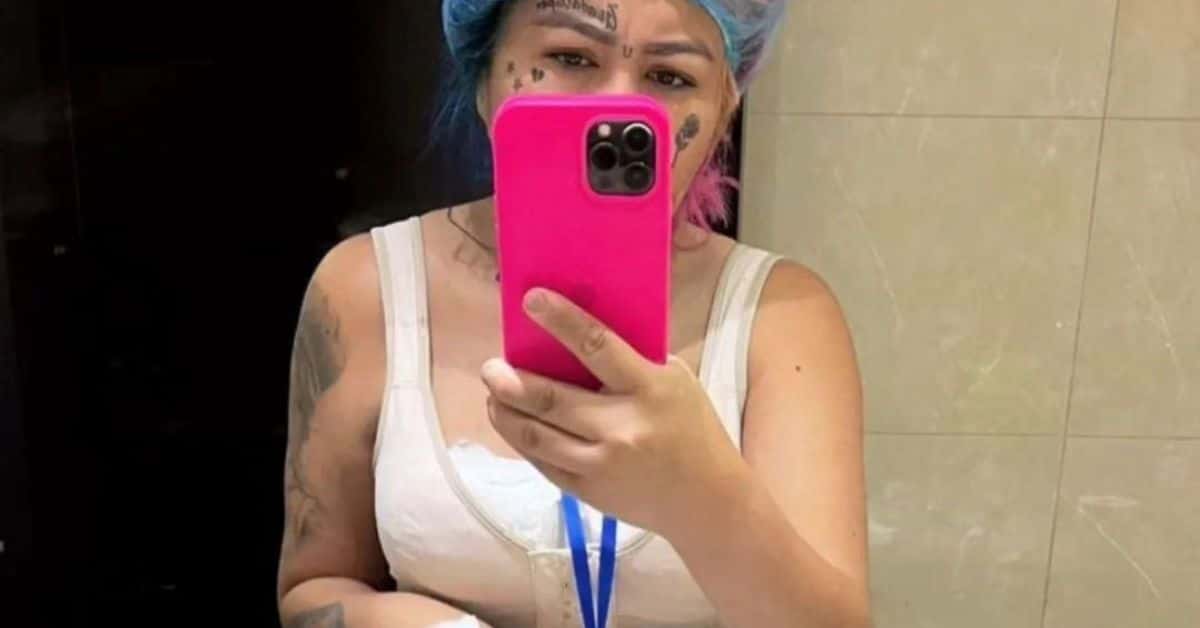 retoque