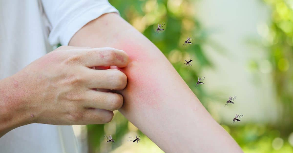 Dengue