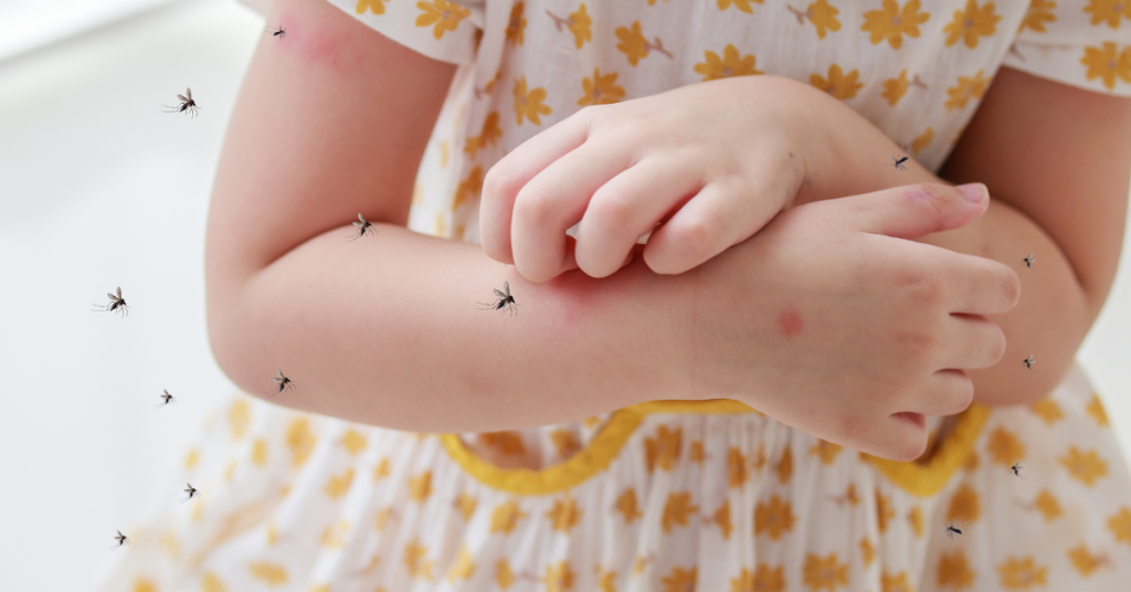Imagen de referencia niña picada mosquitos.