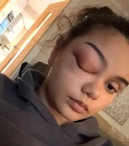 gripa
