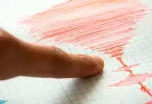 sismo