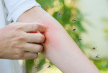 dengue